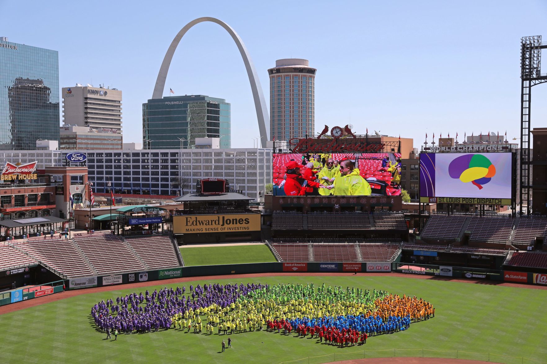 Largest human image of brain